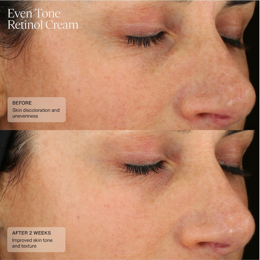 SENTÉ RETINOL CREAM