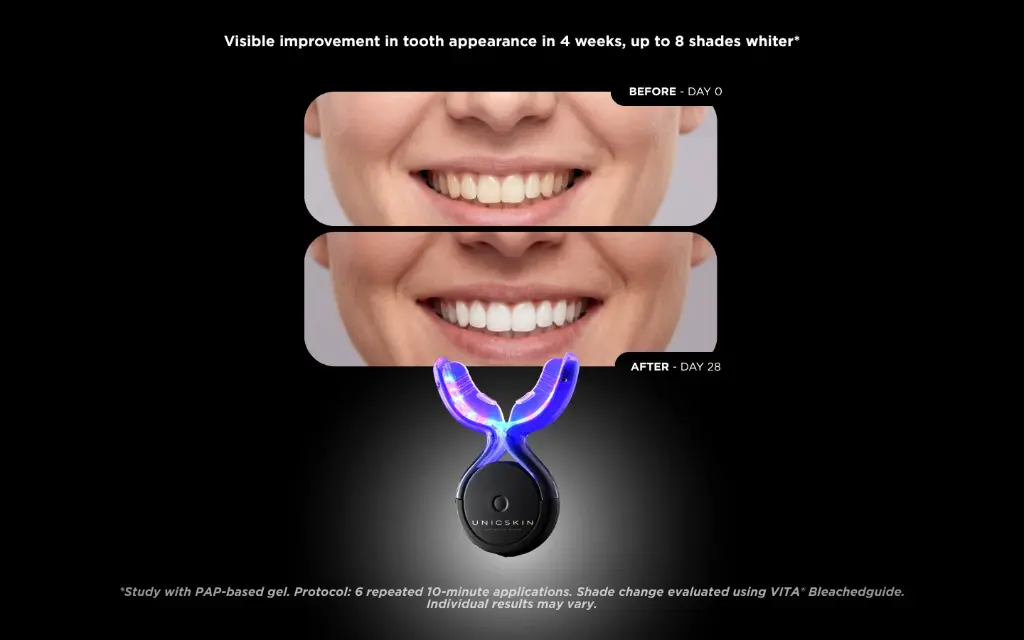 6_Whitesmile_1440x900px_8b870cc1-b89b-48bf-8f1f-be17912b22b3.webp