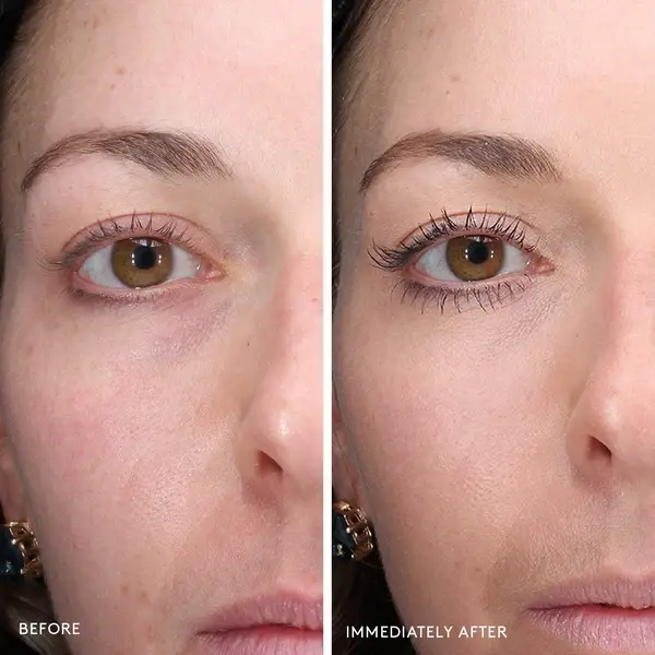 TotalEye_ClinicalStudy_carouselimage.webp