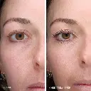 TotalEye_ClinicalStudy_carouselimage.webp